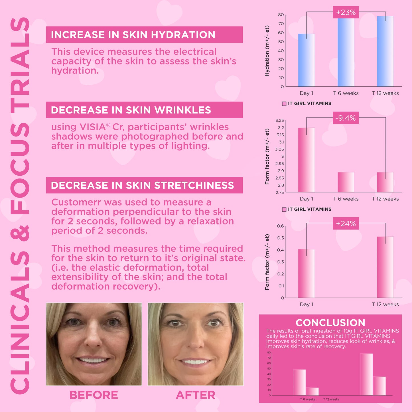 Botox & Filer in a Bottle
