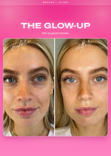 Two facial portraits labeled before and after in an It Girl Skin beauty graphic.